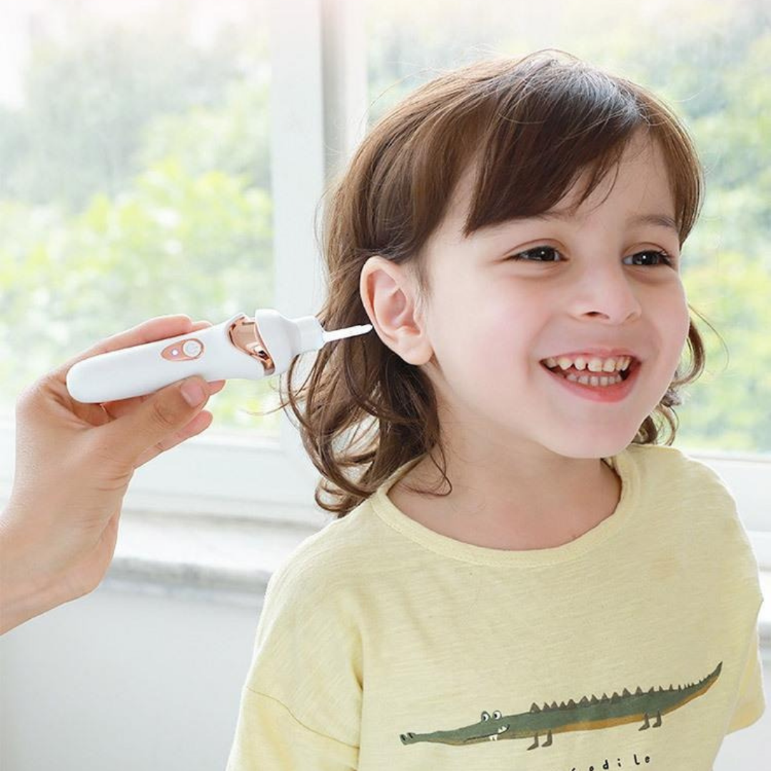 Removedor a Vácuo de Cera de Ouvido - Purity Vacuum.