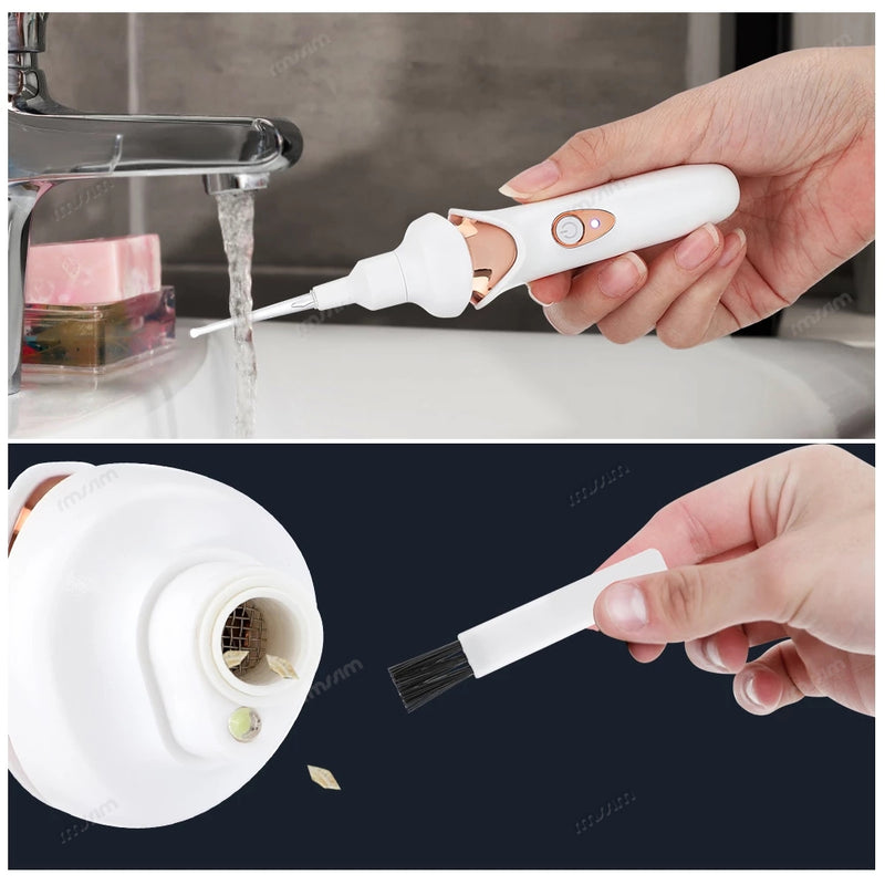 Removedor a Vácuo de Cera de Ouvido - Purity Vacuum.